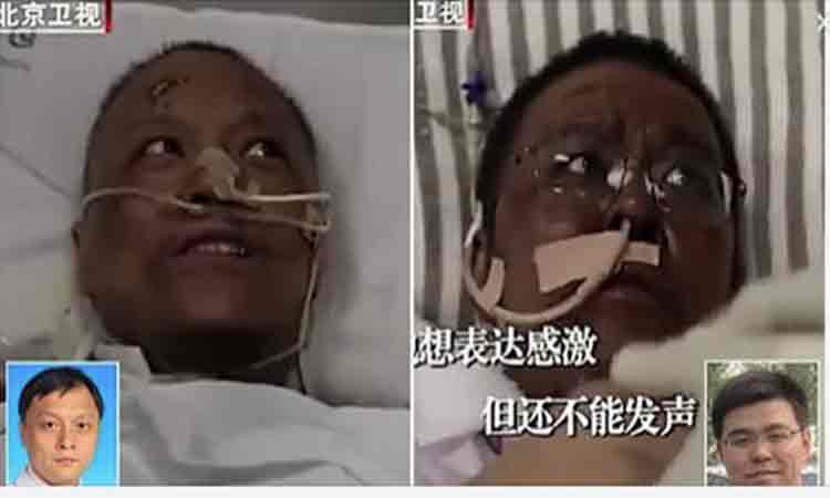 Doi medici chinezi bolnavi de COVID-19 s-au trezit din coma cu pielea neagra. Explicatia specialistilor
