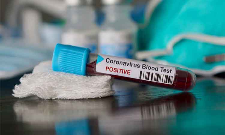 Zece militari confirmați cu noul coronavirus, în Arad
