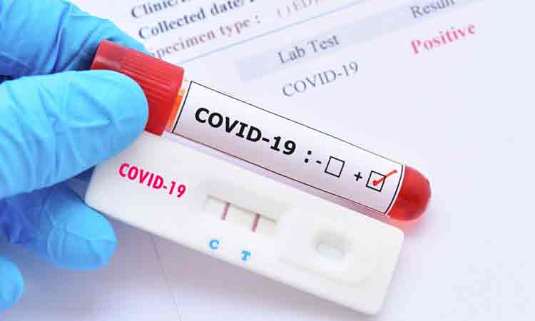 Lista spitalelor care fac teste COVID-19. Cat costa un test