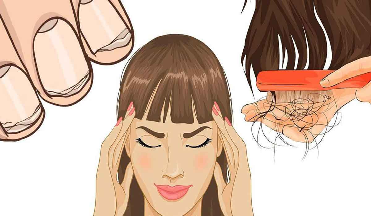 Как пить витамины если выпадают волосы слоятся ногти и кожа