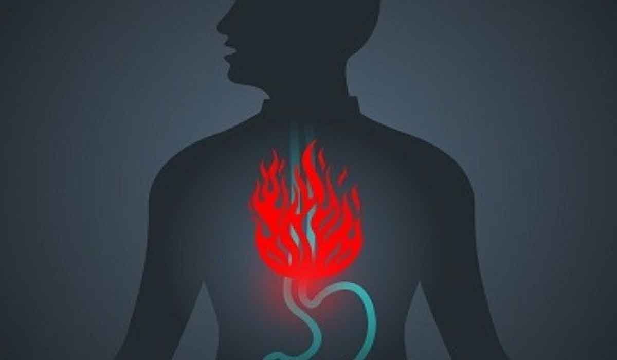 11 remedii naturale pentru arsurile la stomac care functioneaza cu adevarat