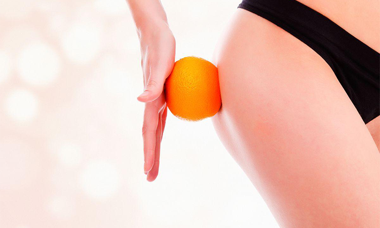 Celulita si coaja de portocala – ce ajuta cu adevarat impotriva lor