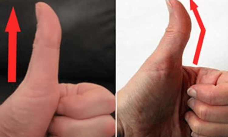 Degetul mare de la mana , sta drept sau usor curbat – uite ce indica acest lucru despre personalitatea ta