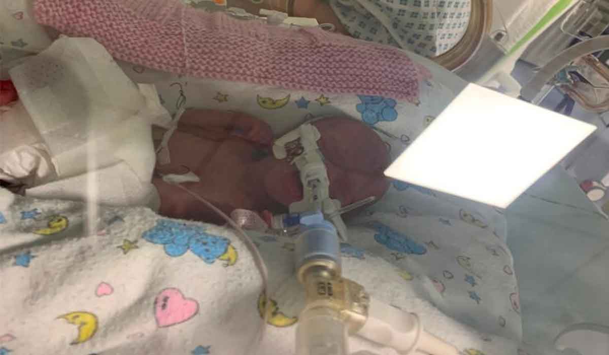 Micuta prematura nascuta cu 13 saptamani mai devreme a fost salvata dupa ce medicii au bagat-o intr-o punga de sandwich