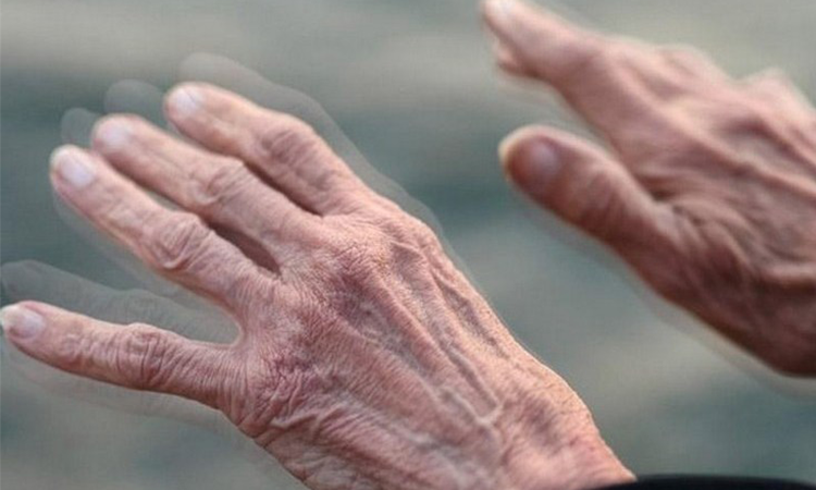 Simptomele timpurii ale bolii Parkinson