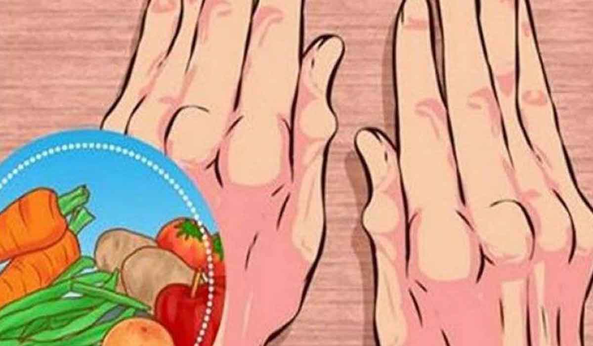 Cinci alimente care ajuta la ameliorarea simptomelor artritei