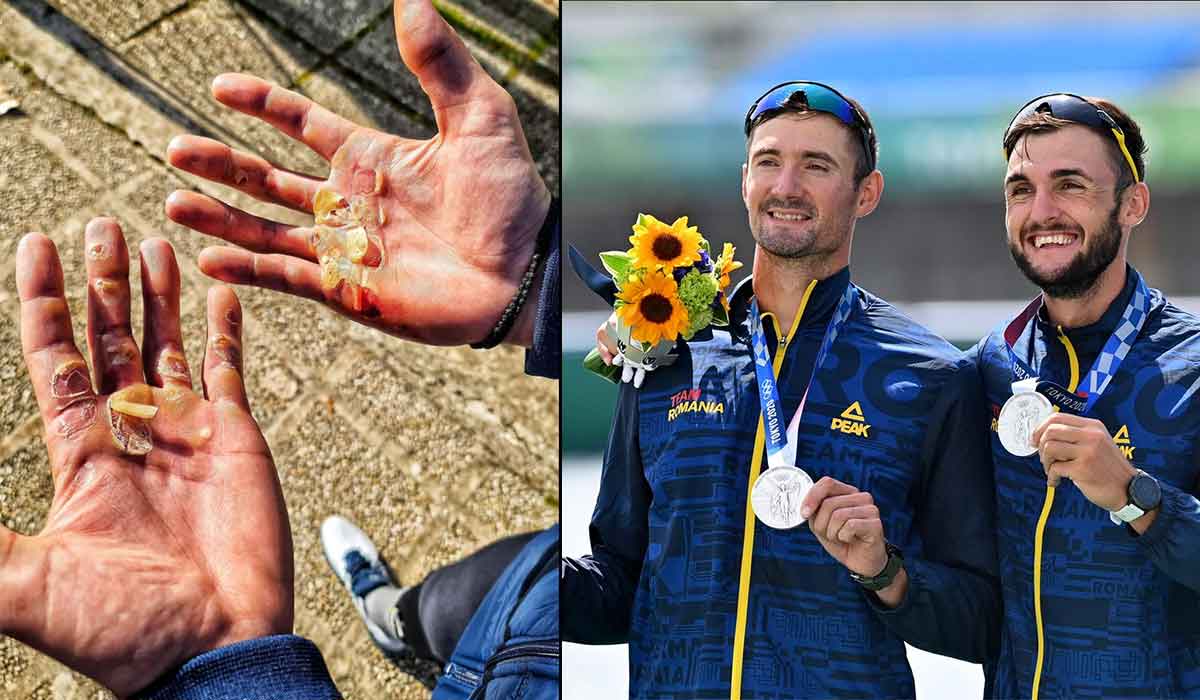 Sacrificiile pentru o medalie olimpica: “Asa arata palmele unui canotor de aur”