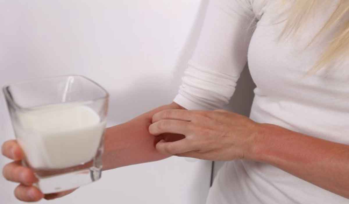 9 simptome ale alergiei la lapte