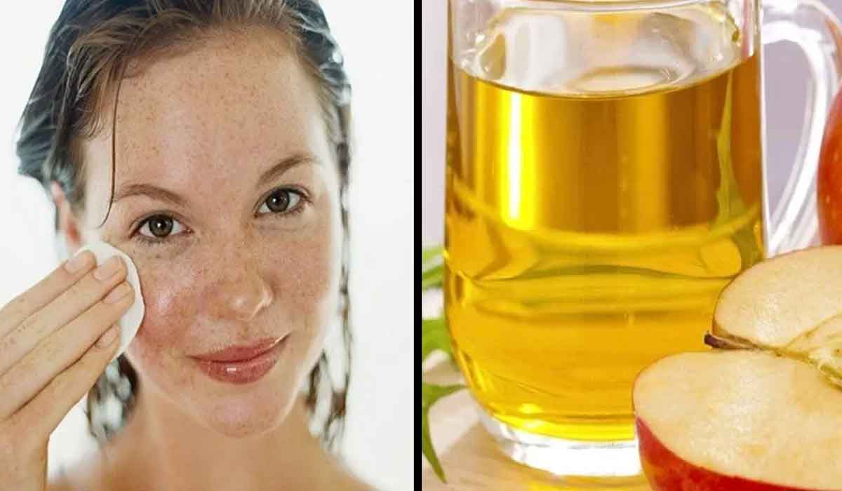 3 beneficii surprinzatoare ale otetului de mere asupra pielii