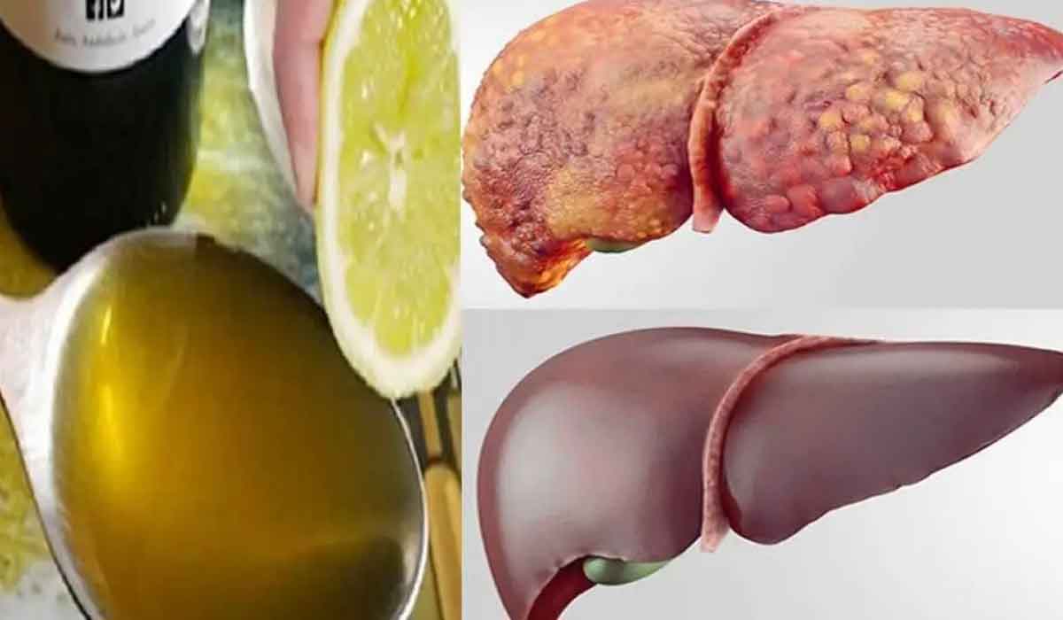 9 alimente care previn boala ficatului gras